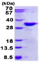 SDS-PAGE - Recombinant Human DKK2 protein (denatured) (AB131710), expandable thumbnail