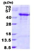 SDS-PAGE - Recombinant Human Dkk3 protein (denatured) (His tag N-Terminus) (AB131700)