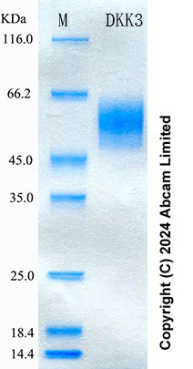 SDS-PAGE - Recombinant Human DKK3 Protein Standard (His tag) (AB316608)