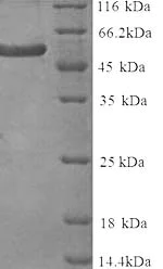 SDS-PAGE - Recombinant Human DLL3 protein (His tag) (AB241447)