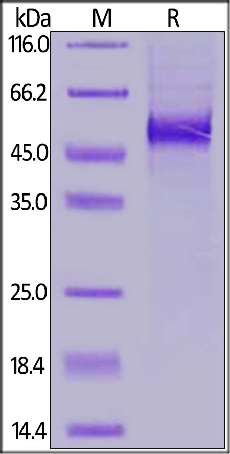 SDS-PAGE - Recombinant Human DLL3 protein (His tag) (AB255797), expandable thumbnail