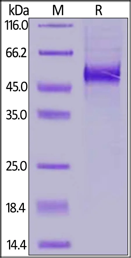 SDS-PAGE - Recombinant Human DLL3 protein (His tag) (AB255797)