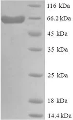 SDS-PAGE - Recombinant Human DLL3 protein (Tagged) (AB226231)