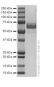 SDS-PAGE - Recombinant Human DLL4 Protein (His Tag) (AB310789)