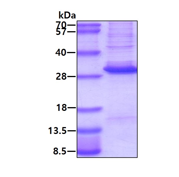 SDS-PAGE - Recombinant Human DLX3 protein (denatured) (His tag N-Terminus) (AB174407)