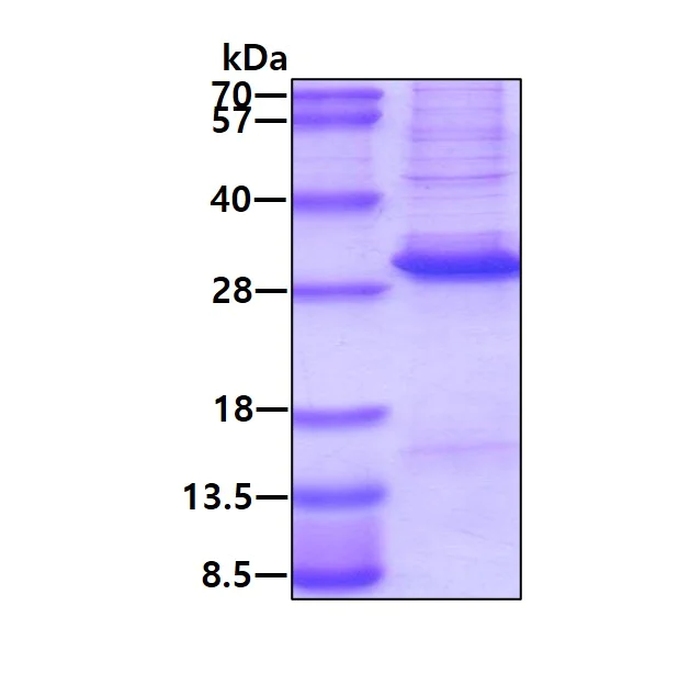 SDS-PAGE - Recombinant Human DLX3 protein (His tag) (denatured) (AB174407)