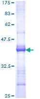 SDS-PAGE - Recombinant Human DMBT1 protein (AB114867), expandable thumbnail