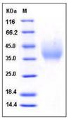 SDS-PAGE - Recombinant Human DMBT1 protein (His tag) (AB276422)