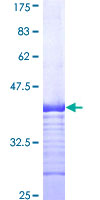 SDS-PAGE - Recombinant Human DMT1 protein (AB159014)