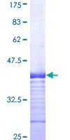 SDS-PAGE - Recombinant Human DMT1 protein (GST tag N-Terminus) (AB159014)