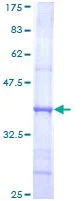 SDS-PAGE - Recombinant Human DNA polymerase alpha/POLA protein (AB114839)