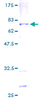 SDS-PAGE - Recombinant Human DNA polymerase eta protein (AB132167)