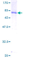 Recombinant Human DNAJA2 protein