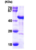 Recombinant Human DNAJB6 protein