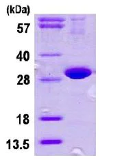 SDS-PAGE - Recombinant Human DNAJB8 protein (AB113587)