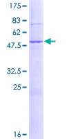 SDS-PAGE - Recombinant Human DNAJB9 protein (AB132017)