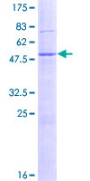 SDS-PAGE - Recombinant Human DNAJB9 protein (AB132017)