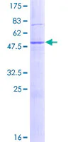 SDS-PAGE - Recombinant Human DNAJB9 protein (GST tag N-Terminus) (AB132017)