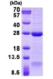 SDS-PAGE - Recombinant Human DNAL1 protein (denatured) (AB140050)