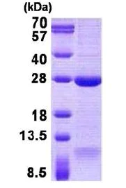 SDS-PAGE - Recombinant Human DNAL1 protein (denatured) (His tag N-Terminus) (AB140050)