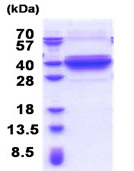 SDS-PAGE - Recombinant Human DNALI1 protein (AB176067), expandable thumbnail