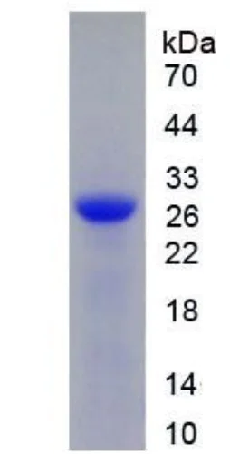 SDS-PAGE - Recombinant human DNase I protein (Active) (AB275555)