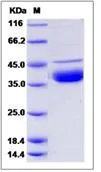 SDS-PAGE - Recombinant Human DNase I protein (His tag) (AB276591)