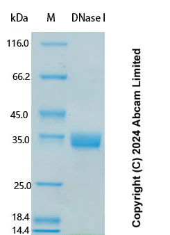 Recombinant Human DNase I Protein Standard (ab323104) | Abcam