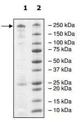SDS-PAGE - Recombinant Human Dnmt1 protein (AB198140)