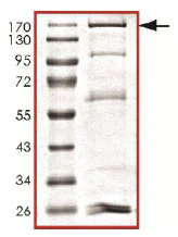 SDS-PAGE - Recombinant human Dnmt3a protein (AB170408)