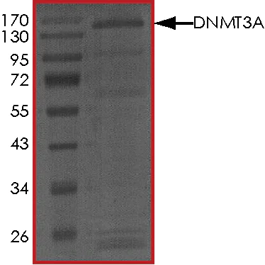 SDS-PAGE - Recombinant human Dnmt3a protein (AB170408)