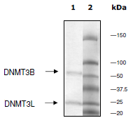 SDS-PAGE - Recombinant human DNMT3B + DNMT3L protein (AB198133), expandable thumbnail