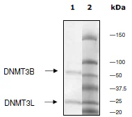SDS-PAGE - Recombinant human DNMT3B + DNMT3L protein (GST tag N-Terminus, His tag N-Terminus) (AB198133)
