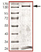 SDS-PAGE - Recombinant human Dnmt3b protein (AB170410)