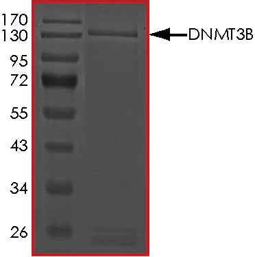 SDS-PAGE - Recombinant human Dnmt3b protein (AB170410)