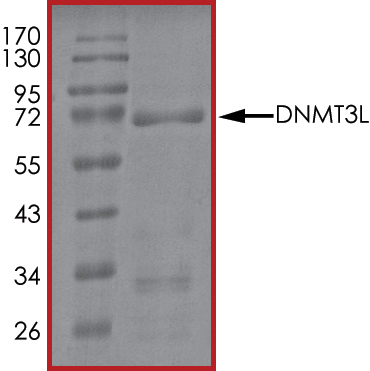 SDS-PAGE - Recombinant human Dnmt3L protein (AB170406), expandable thumbnail