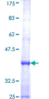 SDS-PAGE - Recombinant Human Dock5 protein (AB164178), expandable thumbnail