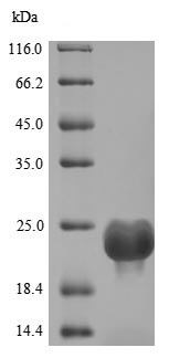 SDS-PAGE - Recombinant Human DOCK8 protein (His tag) (AB241444)