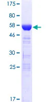 SDS-PAGE - Recombinant Human DOHH protein (AB164401)