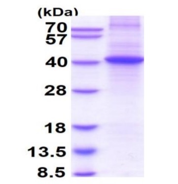 SDS-PAGE - Recombinant Human DOK4 protein (denatured) (AB177645), expandable thumbnail