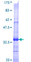 Recombinant Human Dopamine Transporter protein