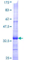 SDS-PAGE - Recombinant Human Dopamine Transporter protein (GST tag N-Terminus) (AB112352)