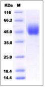 SDS-PAGE - Recombinant Human DPEP1/MDP protein (His tag) (AB276556), expandable thumbnail