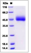 SDS-PAGE - Recombinant Human DPEP2 protein (His tag) (AB276592)