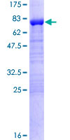 SDS-PAGE - Recombinant Human DPH2 protein (AB158306)