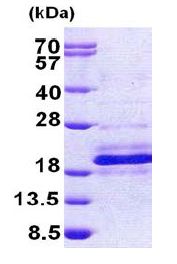 SDS-PAGE - Recombinant Human DPH4 protein (AB156961)