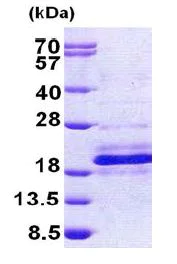 SDS-PAGE - Recombinant Human DPH4 protein (His tag N-Terminus) (AB156961)