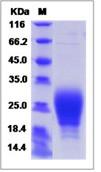 SDS-PAGE - Recombinant Human DPL protein (His tag) (AB276638)
