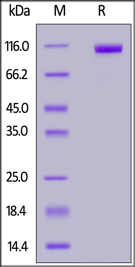 SDS-PAGE - Recombinant Human DPP4 protein (Fc Chimera) (AB155730), expandable thumbnail