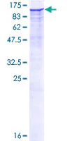 SDS-PAGE - Recombinant Human DPP8 protein (AB162872)